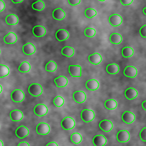 cone segmentation image